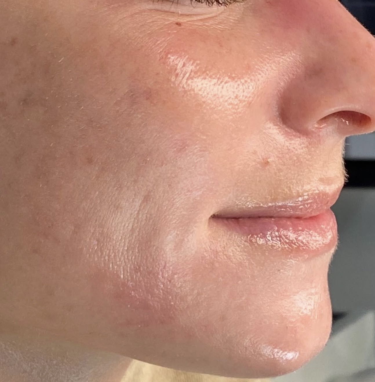 Barrier restored - documented skin journey